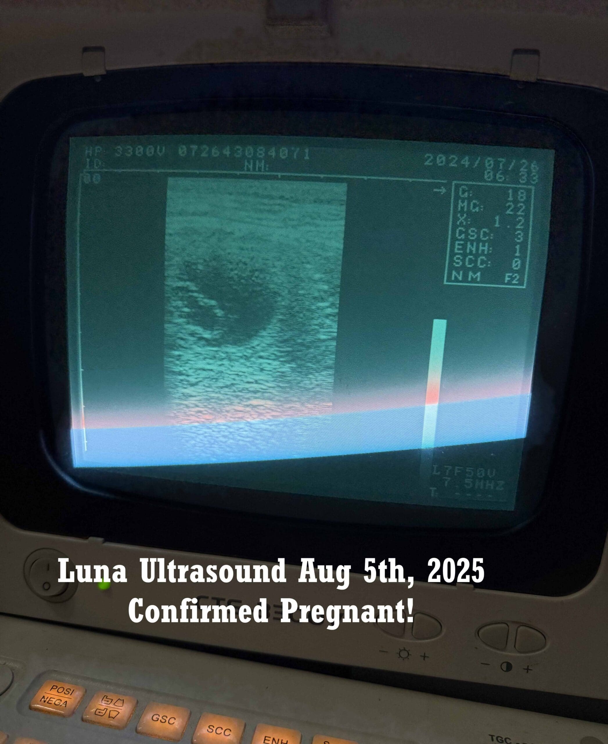 ultrasound 1a gimli